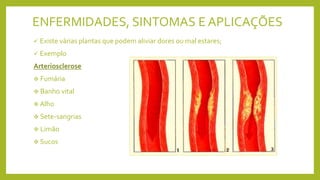 ENFERMIDADES, SINTOMAS E APLICAÇÕES
 Existe várias plantas que podem aliviar dores ou mal estares;
 Exemplo
Arteriosclerose
 Fumária
 Banho vital
 Alho
 Sete-sangrias
 Limão
 Sucos
 