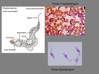 Forme Trypomastigote




Forme Epimastigote
 