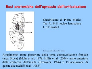 Basi anatomiche dell’aprassia dell’articolazione
Quadrilatero di Pierre Marie:
Tra A, B il nucleo lenticolare
L e l’insula I.
Sezione assiale dell’emisfero sinistro
Attualmente: tratto posteriore della terza circonvoluzione frontale
(area Broca) (Mohr et al., 1978; Hillis et al., 2004), tratto anteriore
della corteccia dell’insula (Dronkers, 1996) e l’associazione di
queste due (Schiff et al., 1983)
 