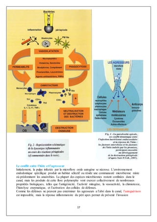 17
Le conflit entre l’hôte et l’agresseur
Initialement, la pulpe infectée par la microflore orale autogène se nécrose. L’environnement
endodontique spécifique produit un habitat sélectif ou réside une communauté microbienne mixte
où prédominent les anaérobies. La plupart des espèces microbiennes restent confinées dans le
canal, mais les produits de cette flore polymorphe vont exercer collectivement de nombreuses
propriétés biologiques, telles que l’antigénicité, l’activité mitogène, la vasoactivité, la chimiotaxie,
l’histolyse enzymatique, et l’activation des cellules de défenses.
Comme les défenses ne peuvent pas exterminer les agresseurs a l’abri dans le canal, l’autoguérison
est impossible, mais la réponse inflammatoire du péri apex permet de prévenir l’invasion
 