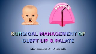 Mohammed	A.	Alawadh
SURGICAL MANAGEMENT OF
CLEFT LIP & PALATE
 