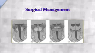 Management of Cleft Lip and Cleft Palate | PDF