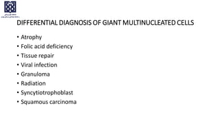 DIFFERENTIAL DIAGNOSIS OF GIANT MULTINUCLEATED CELLS
• Atrophy
• Folic acid deficiency
• Tissue repair
• Viral infection
• Granuloma
• Radiation
• Syncytiotrophoblast
• Squamous carcinoma
 