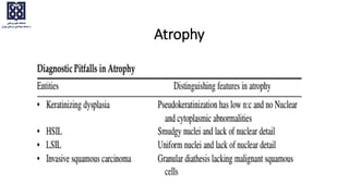 Atrophy
 