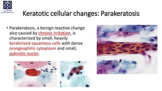 Keratotic cellular changes: Parakeratosis
• Parakeratosis, a benign reactive change
also caused by chronic irritation, is
characterized by small, heavily
keratinized squamous cells with dense
orangeophilic cytoplasm and small,
pyknotic nuclei.
 