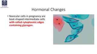 Hormonal Changes
• Navicular cells in pregnancy are
boat-shaped intermediate cells
with rolled cytoplasmic edges
containing glycogen.
 