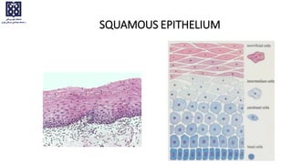 SQUAMOUS EPITHELIUM
 