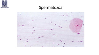 Spermatozoa
 