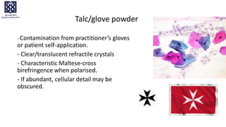 Talc/glove powder
- Contamination from practitioner’s gloves
or patient self-application.
- Clear/translucent refractile crystals
- Characteristic Maltese-cross
birefringence when polarised.
- If abundant, cellular detail may be
obscured.
 