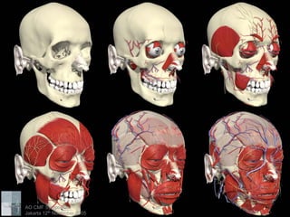 midface anatomy surgical approaches AO craniomaxillofacial symposium | PDF