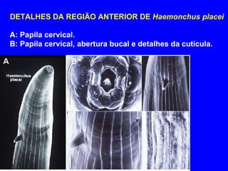 DETALHES DA REGIÃO ANTERIOR DE  Haemonchus placei A: Papila cervical. B: Papila cervical, abertura bucal e detalhes da cutícula. 