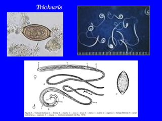 Trichuris 