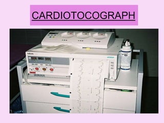 7 non invasive & invasive | PPTX