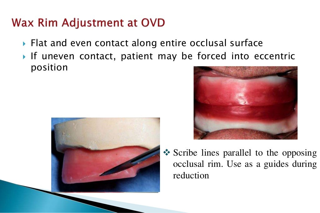occlusion/jaw relation/ centric registeration 4th year tripoli