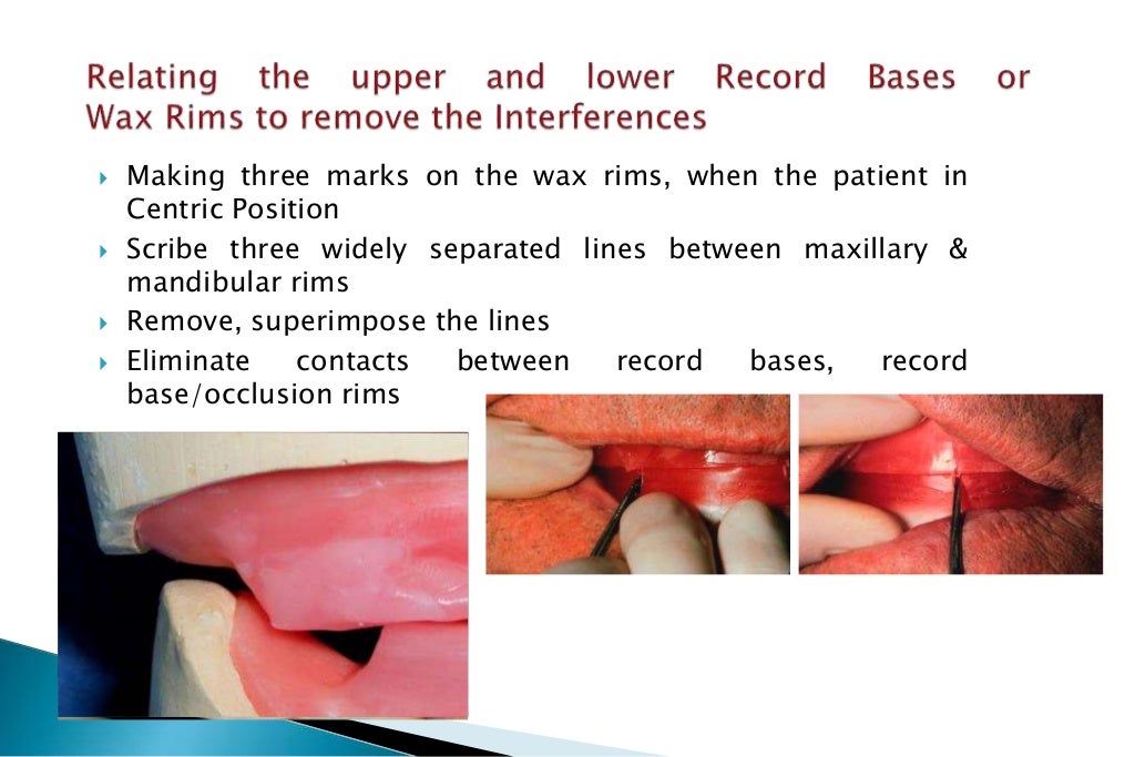 occlusion/jaw relation/ centric registeration 4th year tripoli