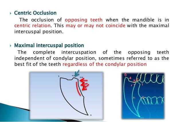 transverse horizontal axis 4 centric