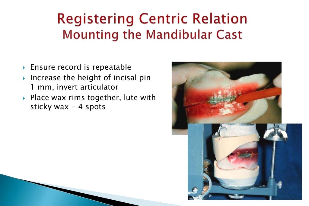 occlusion/jaw relation/ centric registeration 4th year tripoli