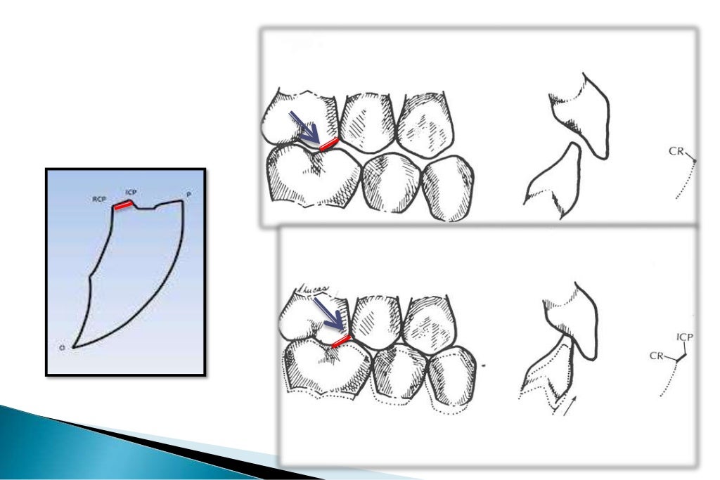 occlusion/jaw relation/ centric registeration 4th year tripoli