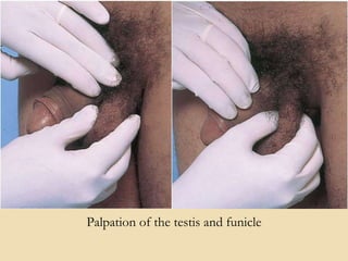 Palpation of the testis and funicle
 