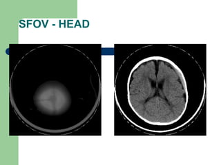 7 Physical principles of CT.pptasfbmhjugr | PPT