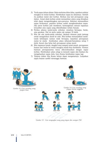 214 Kelas VII SMP/MTs
3)	 Tarik napas dalam-dalam. Buka mulutmu lebar-lebar, rapatkan sedekat
mungkin ke mulut korban. Hembuskan napas ke dalamnya. Setelah
itu jauhkan mulut dari korban. Berikan dua kali pernapasan yang
dalam. Amati dada korban untuk memastikan udara yang ditiupkan
telah dapat mengembangkan paru-parunya. Sebelum memasukkan
napas berikutnya, pastikan korban sudah menghembuskan napas.
Jika perut korban jadi membesar, kemungkinan saluran napasnya
tersumbat atau napas yang dihembuskan terlalu banyak.
4)	 Periksa adanya tanda-tanda sirkulasi, misalnya bernapas, batuk,
atau gerakan. Hal ini perlu waktu tak sampai 10 detik.
5)	 Bila tak ada tanda-tanda sirkulasi, lakukan tekanan pada jantung
untuk mengalirkan darah ke otak. Bila korban menunjukkan tanda-
tanda kehidupan namun tidak bernapas, lanjutkan pernapasan
mulut ke mulut hembuskan udara sebanyak-banyaknya setiap 5
detik, berarti dua belas kali pernapasan setiap menit.
6)	 Bila napasnya lemah, dangkal atau tampak susah payah, pernapasan
buatan dari mulut ke mulut mungkin masih bisa membantu. Namun
bantuan pernapasanmu harus dikoordinasikan dengan napas
korban. Hembuskan udara selagi ia menarik napas dan biarkan dia
mengeluarkan napas dulu, baru Kamu hembuskan napas lagi.
7)	 Telepon dokter bila Kamu belum dapat mengatasinya. Lanjutkan
napas buatan sambil menunggu bantuan.
Gambar 9.3 Cara menolong orang
pingsan biasa
Gambar 9.4 Cara menolong orang
pingsan karena tenggelam
Gambar 9.5 Cara mengangkat orang yang pingsan dan usungan P3K
 