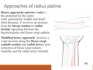 7 PREFINAL MARCH JC AMIT PAEDIATRICS FRACTURE [Autosaved].pptx