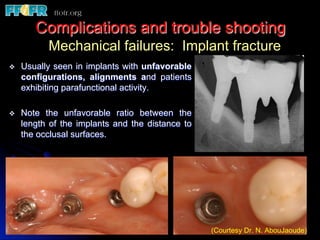 Complications and trouble shooting
v  Usually seen in implants with unfavorable
configurations, alignments and patients
exhibiting parafunctional activity.
v  Note the unfavorable ratio between the
length of the implants and the distance to
the occlusal surfaces.
Mechanical failures: Implant fracture
(Courtesy Dr. N. AbouJaoude)
 