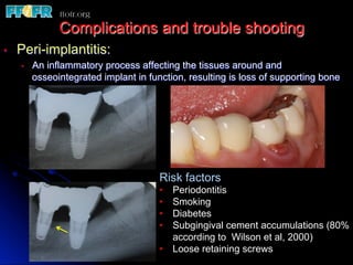 •  Peri-implantitis:
•  An inflammatory process affecting the tissues around and
osseointegrated implant in function, resulting is loss of supporting bone
Complications and trouble shooting
Risk factors
•  Periodontitis
•  Smoking
•  Diabetes
•  Subgingival cement accumulations (80%
according to Wilson et al, 2000)
•  Loose retaining screws
 