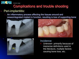 •  Peri-implantitis:
•  An inflammatory process affecting the tissues around and
osseointegrated implant in function, resulting is loss of supporting bone
Complications and trouble shooting
Incidence
§  Unknown primarily because of
imprecise definitions used in
the literature, multiple factors
causing bone loss, etc.
 