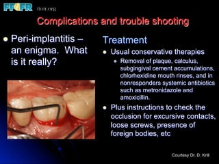 l  Peri-implantitis –
an enigma. What
is it really?
Treatment
l  Usual conservative therapies
l  Removal of plaque, calculus,
subgingival cement accumulations,
chlorhexidine mouth rinses, and in
nonresponders systemic antibiotics
such as metronidazole and
amoxicillin.
l  Plus instructions to check the
occlusion for excursive contacts,
loose screws, presence of
foreign bodies, etc
Complications and trouble shooting
Courtesy Dr. D. Krill
 