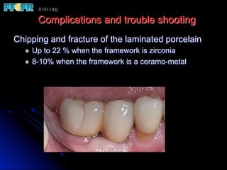 Chipping and fracture of the laminated porcelain
l  Up to 22 % when the framework is zirconia
l  8-10% when the framework is a ceramo-metal
Complications and trouble shooting
 