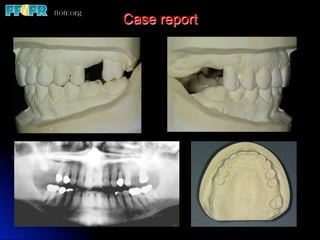 Case report
 