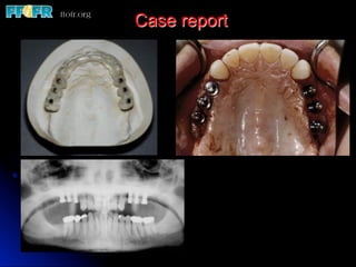 Case report
 