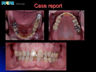Case report
 