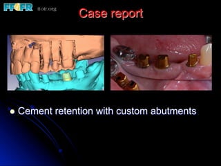 Case report
l  Cement retention with custom abutments
 