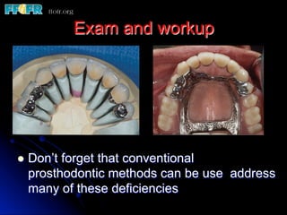 Exam and workup
l  Don’t forget that conventional
prosthodontic methods can be use address
many of these deficiencies
 