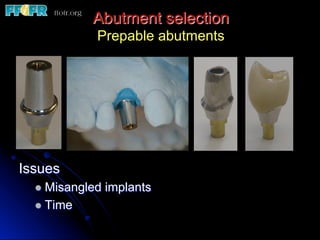 Abutment selection
Prepable abutments
Issues
l  Misangled implants
l  Time
 
