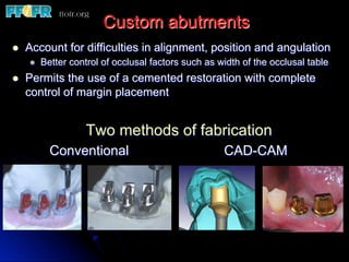 Custom abutments
Two methods of fabrication
Conventional CAD-CAM
l  Account for difficulties in alignment, position and angulation
l  Better control of occlusal factors such as width of the occlusal table
l  Permits the use of a cemented restoration with complete
control of margin placement
 