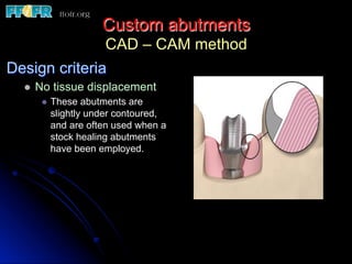 Custom abutments
CAD – CAM method
Design criteria
l  No tissue displacement
l  These abutments are
slightly under contoured,
and are often used when a
stock healing abutments
have been employed.
 