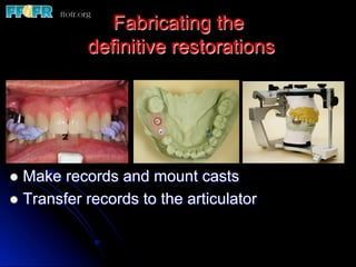 Fabricating the
definitive restorations
l  Make records and mount casts
l  Transfer records to the articulator
 