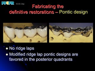 Fabricating the
definitive restorations – Pontic design
l  No ridge laps
l  Modified ridge lap pontic designs are
favored in the posterior quadrants
 