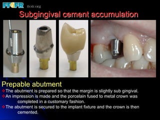 Subgingival cement accumulation
Prepable abutment
v The abutment is prepared so that the margin is slightly sub gingival.
v An impression is made and the porcelain fused to metal crown was
completed in a customary fashion.
v The abutment is secured to the implant fixture and the crown is then
cemented.
 
