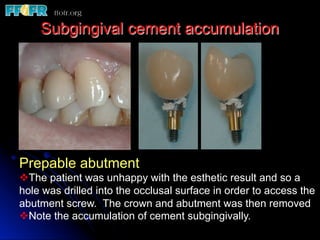 Subgingival cement accumulation
Prepable abutment
v The patient was unhappy with the esthetic result and so a
hole was drilled into the occlusal surface in order to access the
abutment screw. The crown and abutment was then removed
v Note the accumulation of cement subgingivally.
 