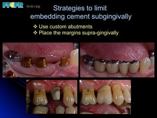 Strategies to limit
embedding cement subgingivally
v Use custom abutments
v Place the margins supra-gingivally
 