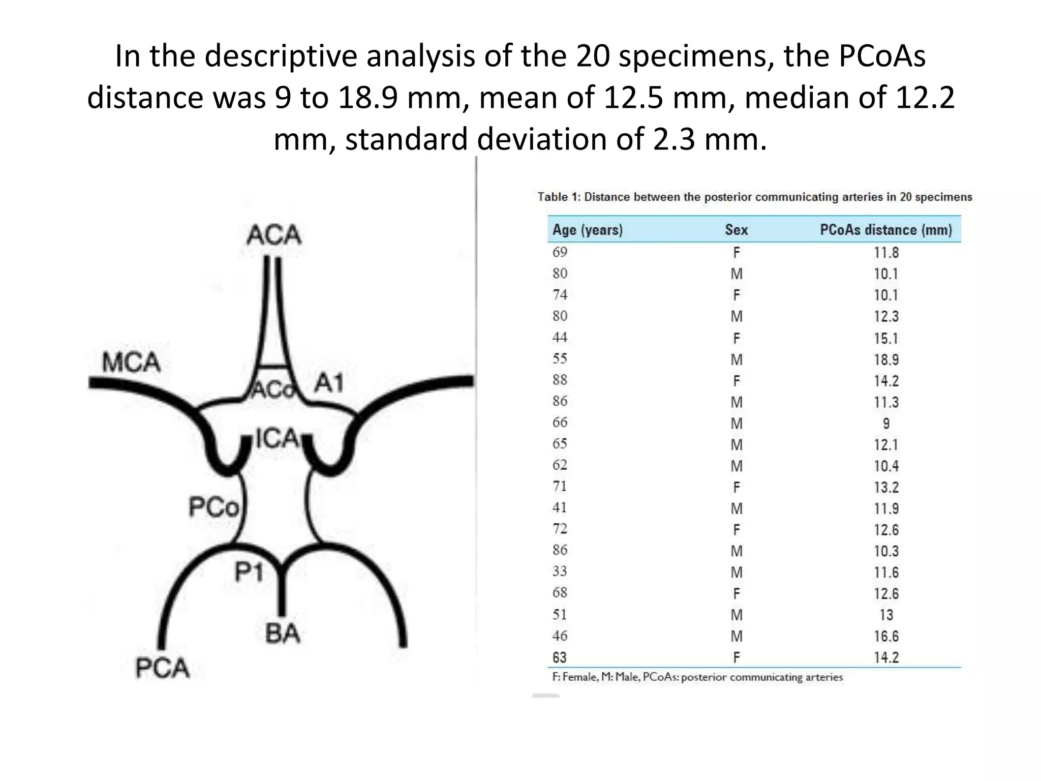 In the descriptive analysis of the 20 specimens, the PCoAs
distance was 9 to 18.9 mm, mean of 12.5 mm, median of 12.2
mm, standard deviation of 2.3 mm.
 