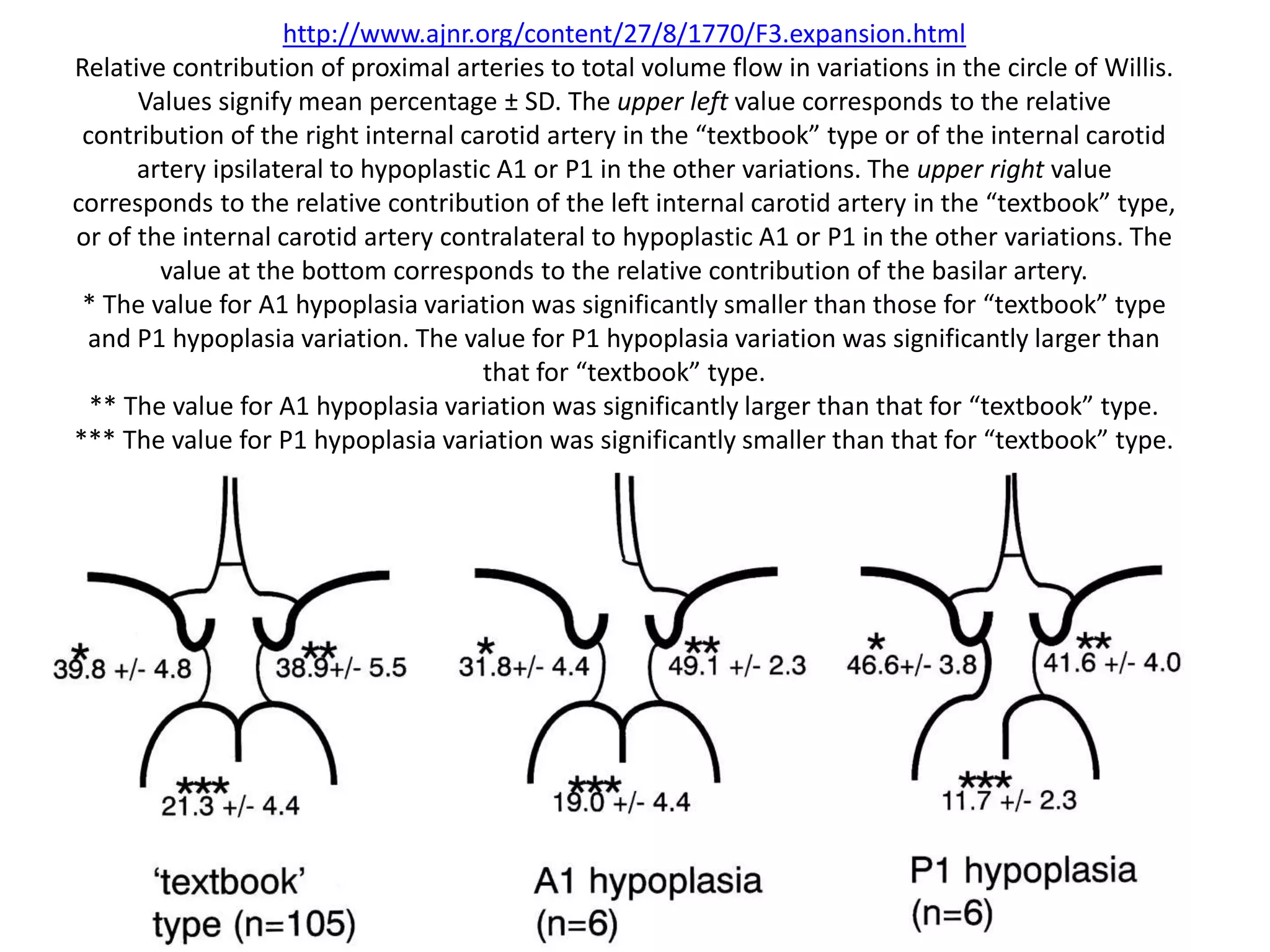 http://www.ajnr.org/content/27/8/1770/F3.expansion.html
Relative contribution of proximal arteries to total volume flow in variations in the circle of Willis.
Values signify mean percentage ± SD. The upper left value corresponds to the relative
contribution of the right internal carotid artery in the “textbook” type or of the internal carotid
artery ipsilateral to hypoplastic A1 or P1 in the other variations. The upper right value
corresponds to the relative contribution of the left internal carotid artery in the “textbook” type,
or of the internal carotid artery contralateral to hypoplastic A1 or P1 in the other variations. The
value at the bottom corresponds to the relative contribution of the basilar artery.
* The value for A1 hypoplasia variation was significantly smaller than those for “textbook” type
and P1 hypoplasia variation. The value for P1 hypoplasia variation was significantly larger than
that for “textbook” type.
** The value for A1 hypoplasia variation was significantly larger than that for “textbook” type.
*** The value for P1 hypoplasia variation was significantly smaller than that for “textbook” type.
 