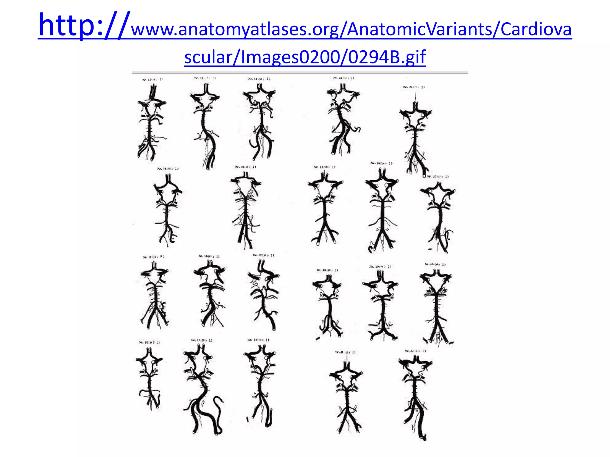 http://www.anatomyatlases.org/AnatomicVariants/Cardiova
scular/Images0200/0294B.gif
 