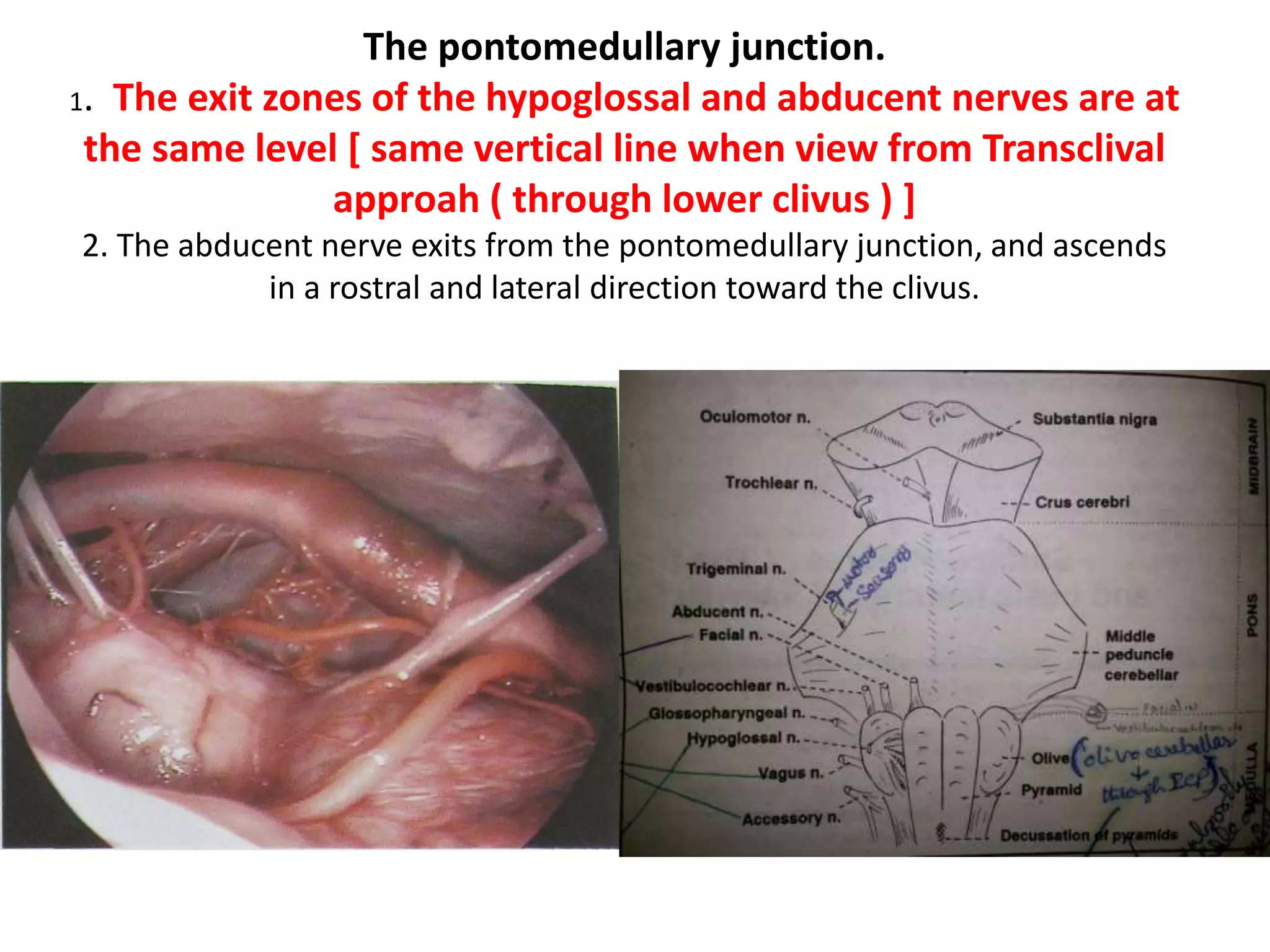 The pontomedullary junction.
1. The exit zones of the hypoglossal and abducent nerves are at
the same level [ same vertical line when view from Transclival
approah ( through lower clivus ) ]
2. The abducent nerve exits from the pontomedullary junction, and ascends
in a rostral and lateral direction toward the clivus.
 