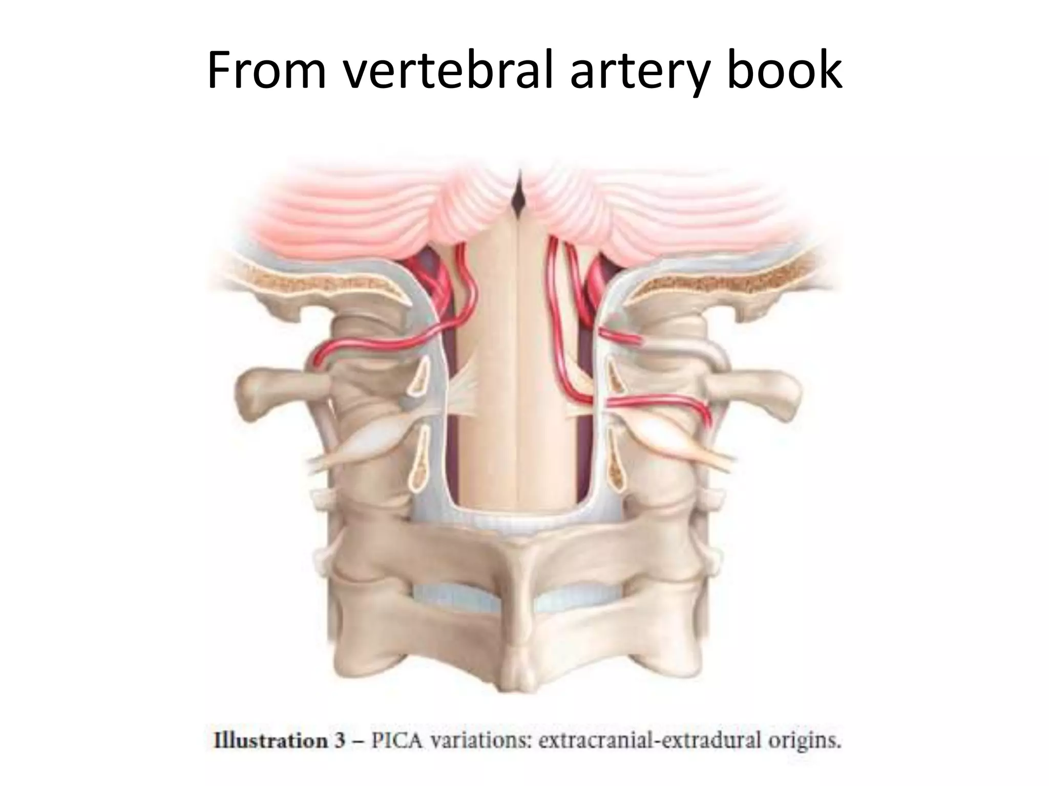 From vertebral artery book
 