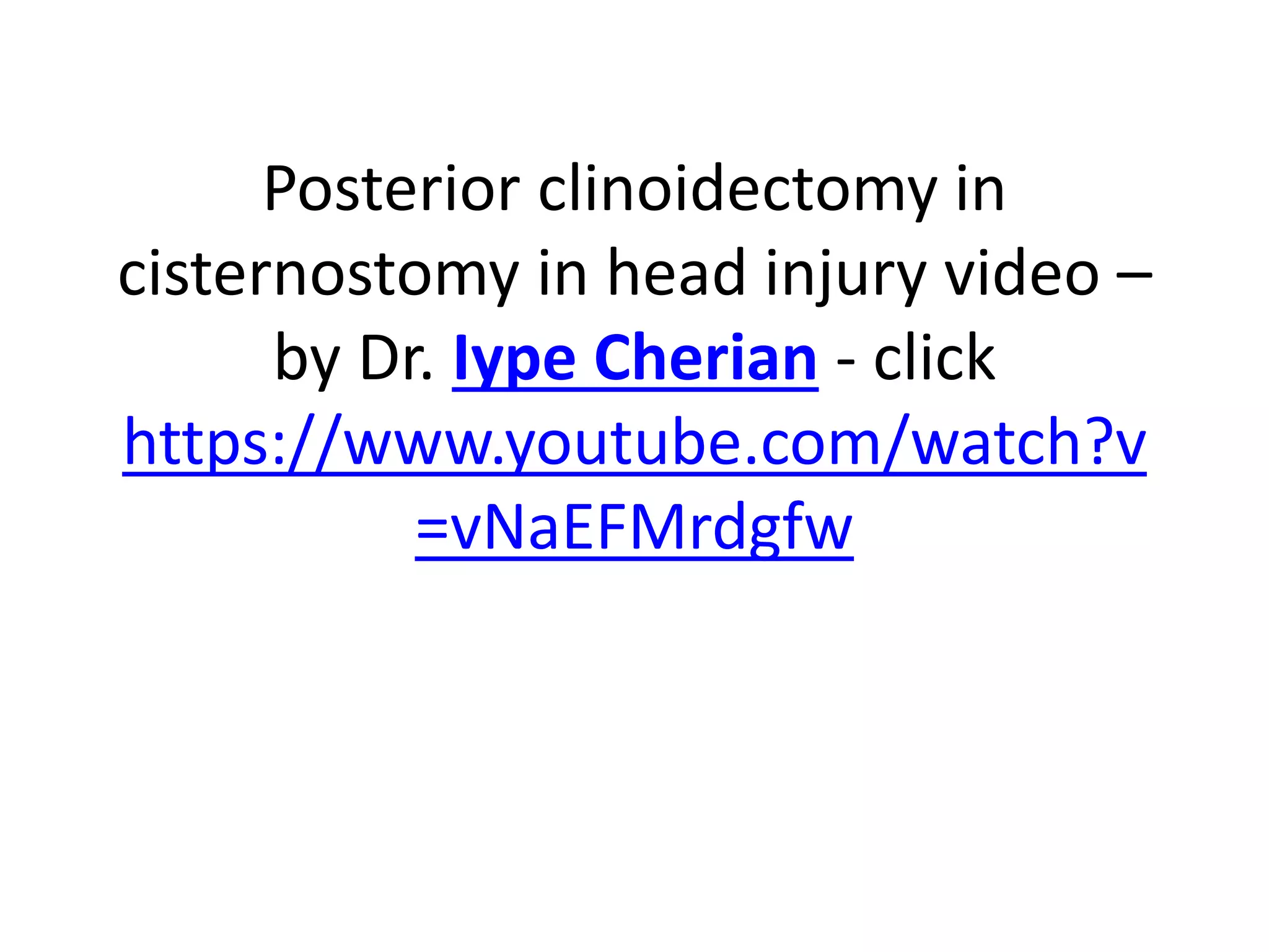 Posterior clinoidectomy in
cisternostomy in head injury video –
by Dr. Iype Cherian - click
https://www.youtube.com/watch?v
=vNaEFMrdgfw
 